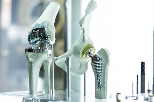 Total Joint Replacement at Dr. Horn Orthopedics in Baytown